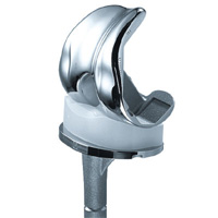 Schéma de la chirurgie du genou