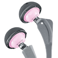 schéma de chirurgie de la hanche