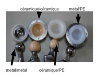 schéma de chirurgie de la hanche