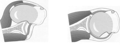 Schema chirurgie de la main