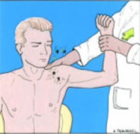 Schema chirurgie de la main