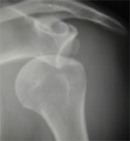 Schema chirurgie de la main