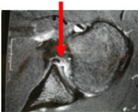 Schema chirurgie de la main