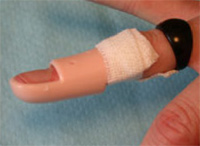 Schema chirurgie de la main