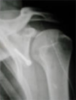 Schema chirurgie de la main