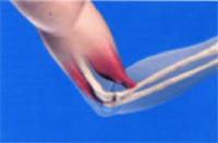 Schema chirurgie de la main