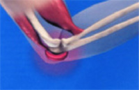 Schema chirurgie de la main