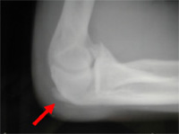 Schema chirurgie de la main