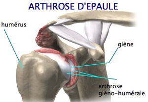 Schema chirurgie de la main