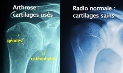 Schema chirurgie de la main