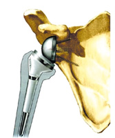 Schema chirurgie de la main