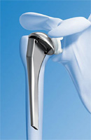 Schema chirurgie de la main