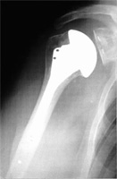 Schema chirurgie de la main